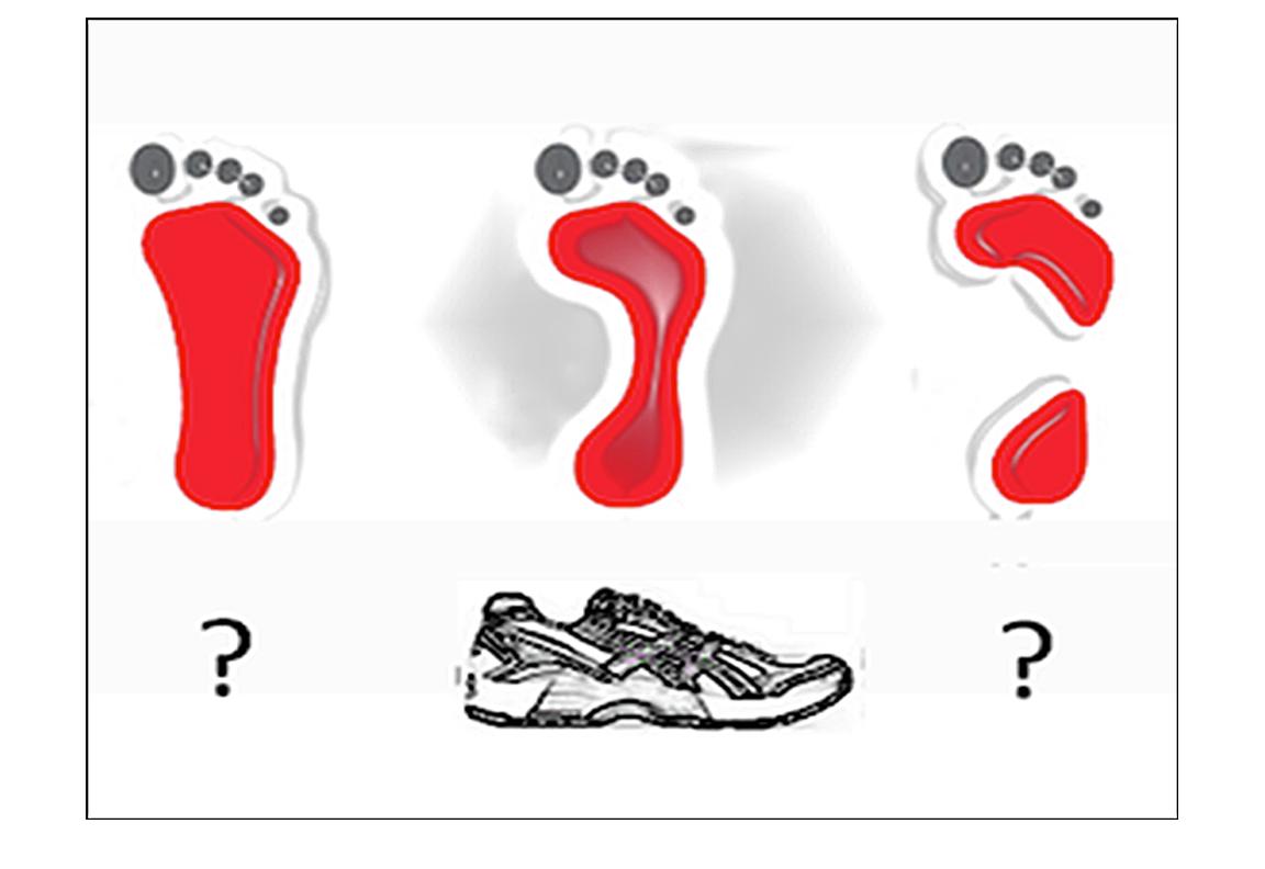 The Running Shoe Dilemma